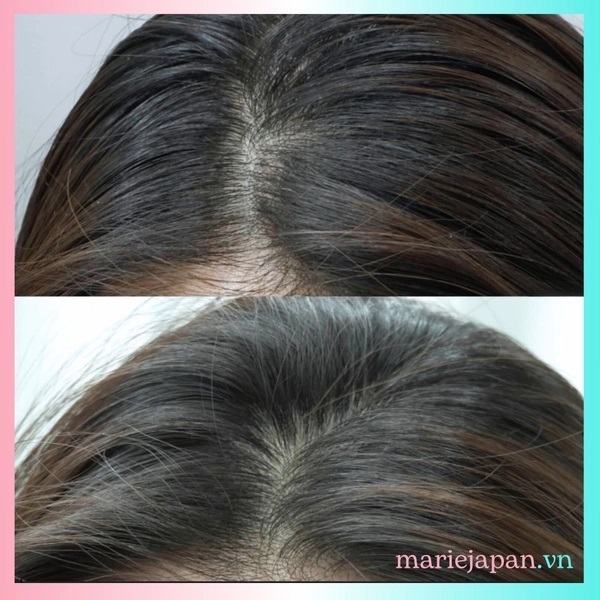 Tinh Chất Mọc Tóc Sato Nhật Bản Chai 30ml Tặng Kèm Chai Xịt