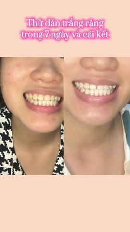 Kem Đánh Răng Trắng Sạch Crest Gum Detoxify Deep Clean 116g