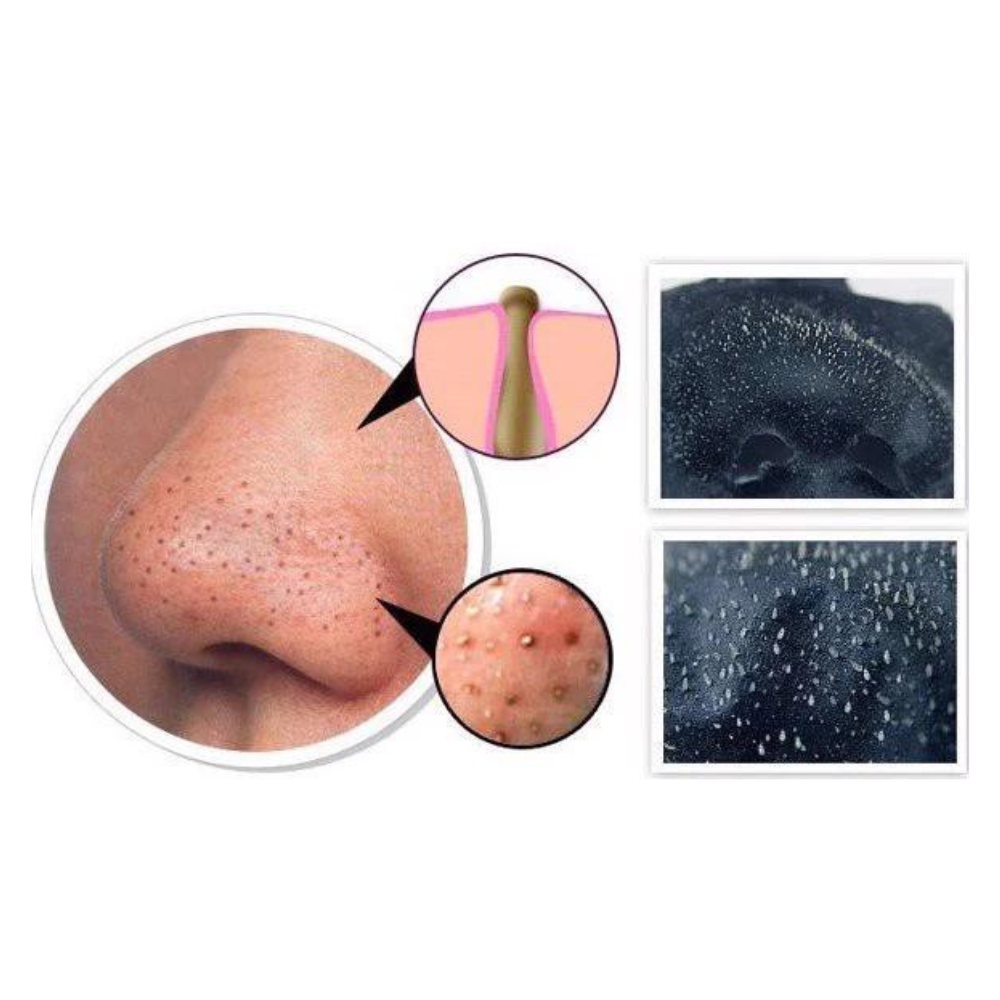 Miếng Lột Mụn Đầu Đen Lachesca Kose Softymo Hộp 10 Miếng Nhật Bản