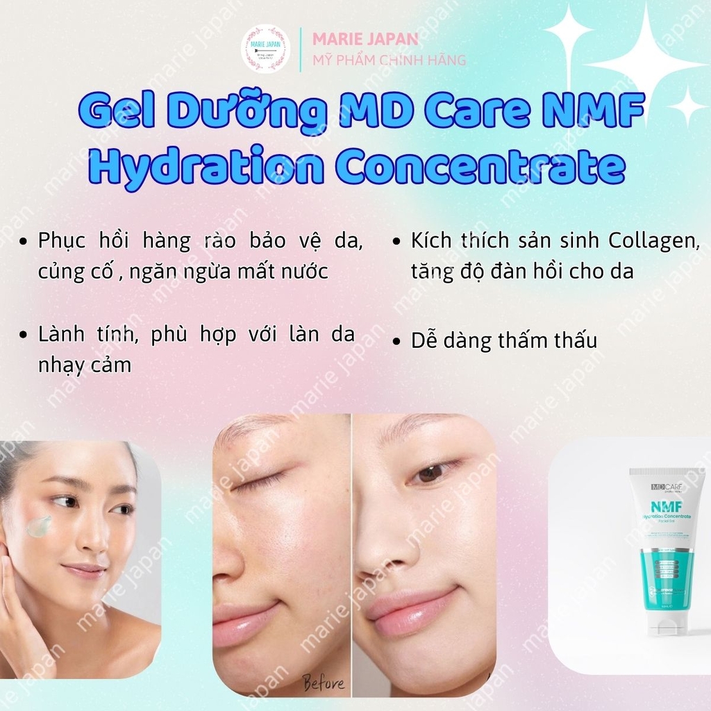 Gel Dưỡng MD Care NMF Hydration Concentrate Facial Kiềm Dầu Cấp Ẩm Phục Hồi Da Tuýp 50ml