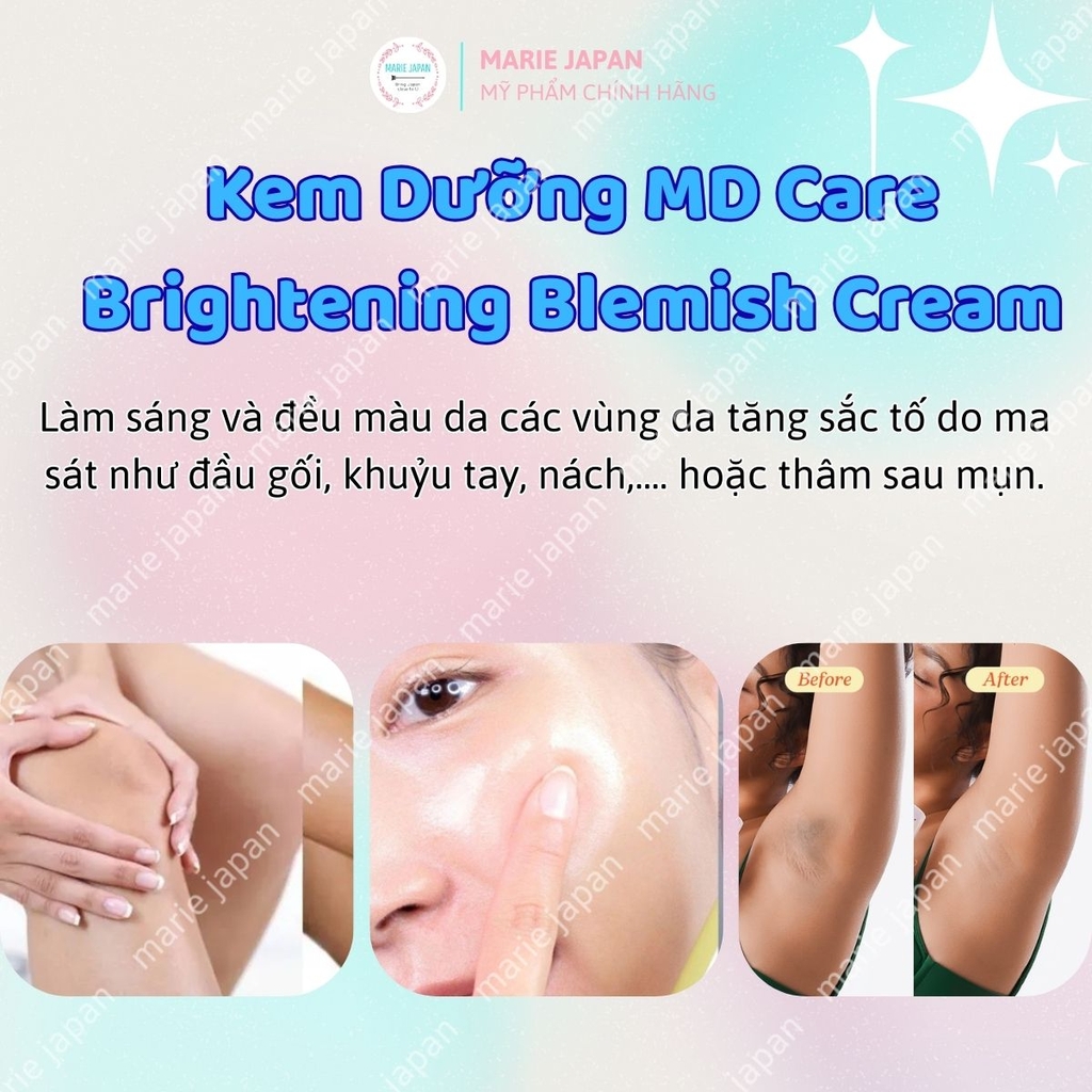Kem Dưỡng MD CARE Brightening Blemish Cream Dưỡng Sáng Đều Màu Da Cấp Ẩm Chuyên Sâu 50ml