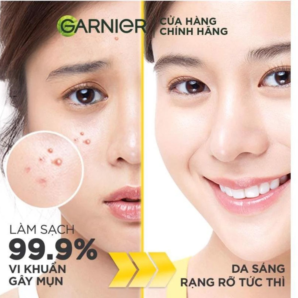Sữa Rửa Mặt Garnier 3in1 Giảm Mụn Dưỡng Sáng Da Bright Complete Anti-Acne MẪU MỚI Pháp 100ml