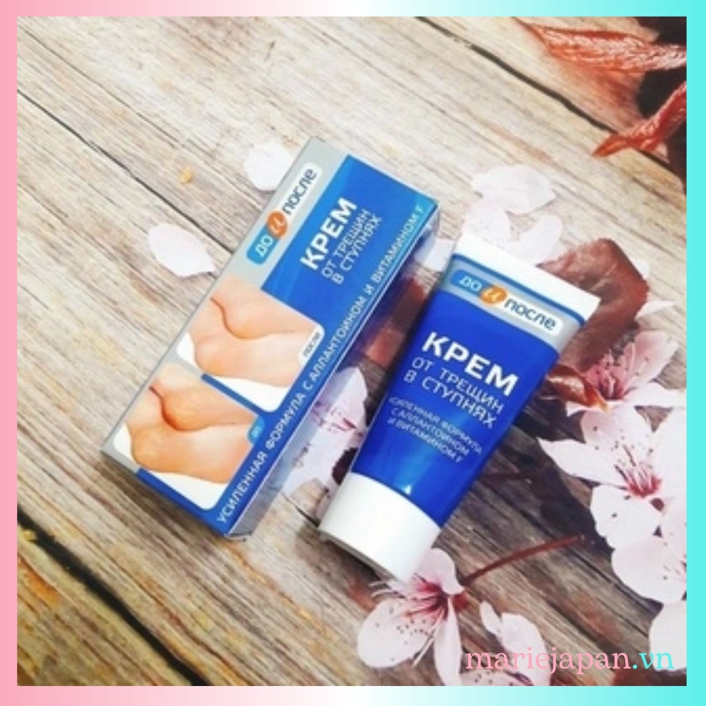 Kem Nẻ Gót Chân Kpem Nga Tuýp 50ml