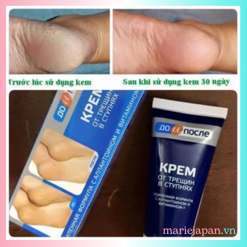 Kem Nẻ Gót Chân Kpem Nga Tuýp 50ml
