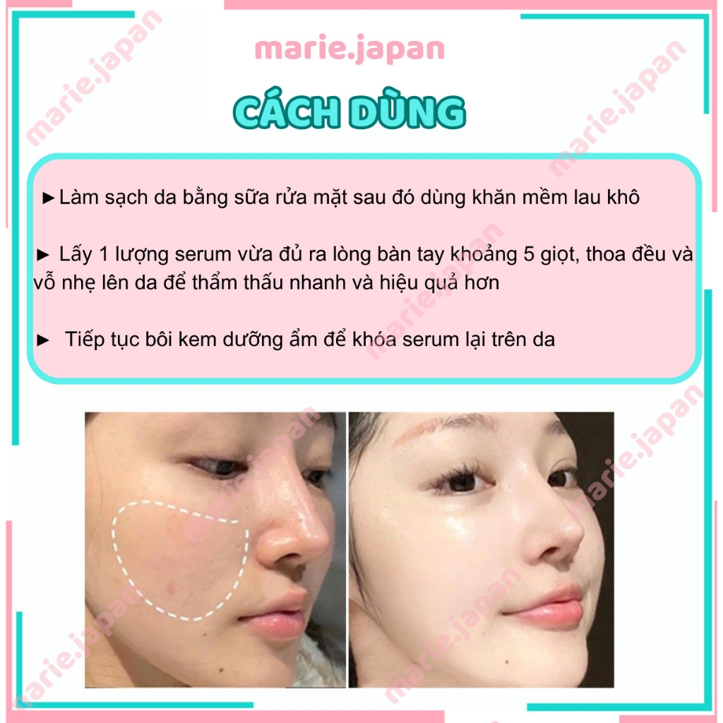 Serum Balance Niacinamide 15% Blemish Recovery Chai 30ml