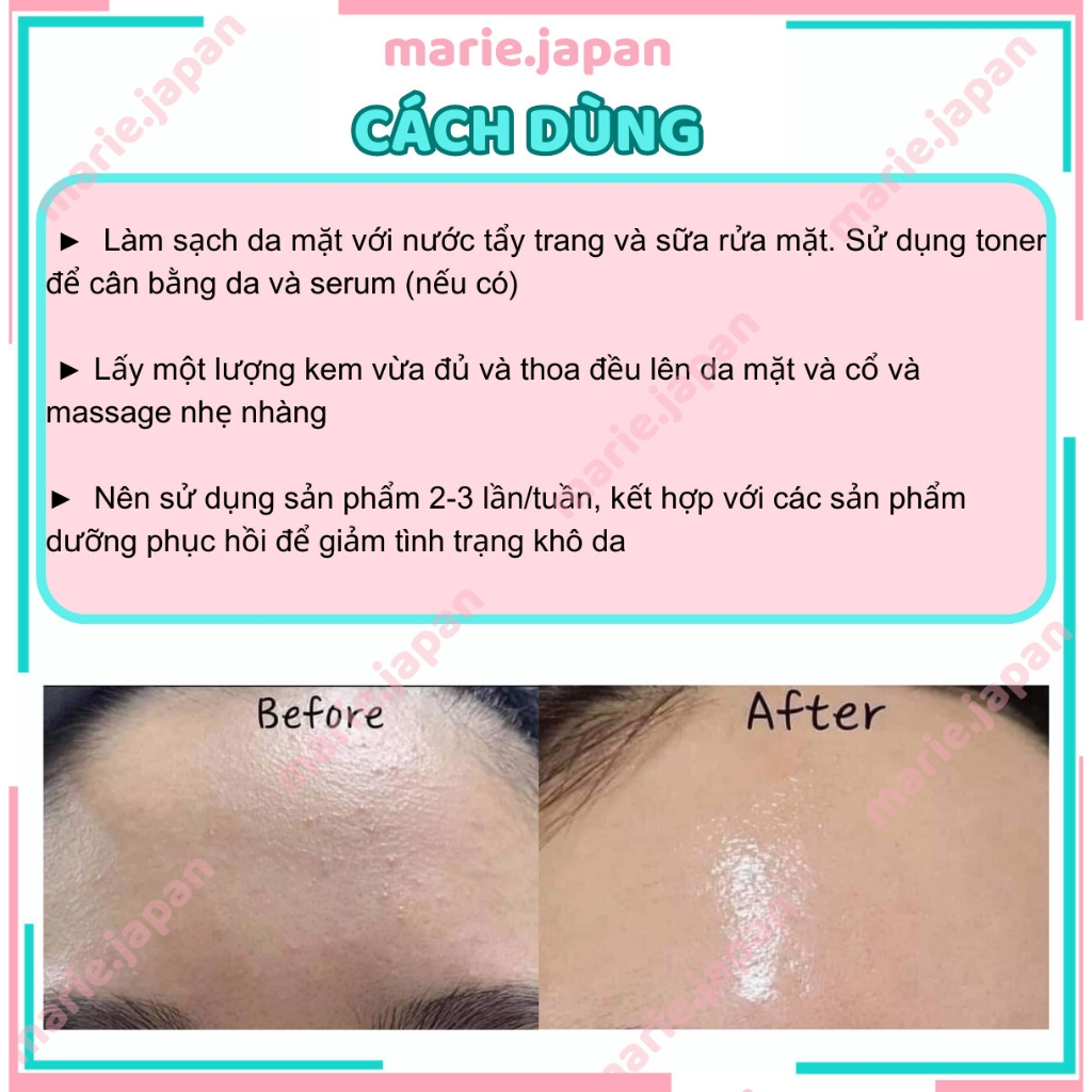 Kem Dưỡng Retinol K Lady Care Giữ Ẩm Căng Bóng Da Hàn Quốc 30ml