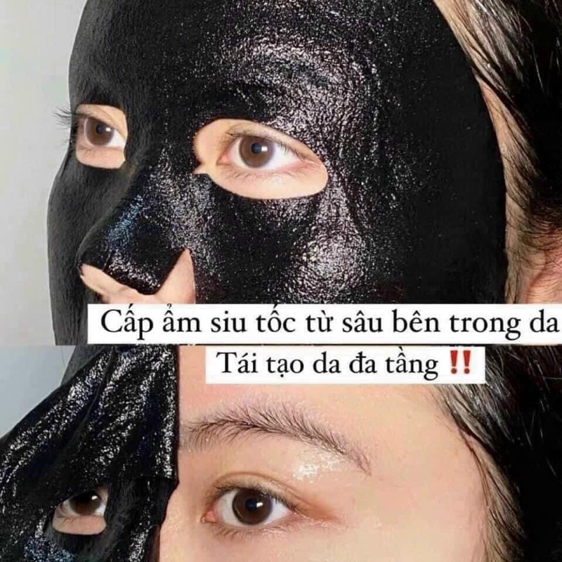 Mặt Nạ Yuejin MELASMA SOS Mask