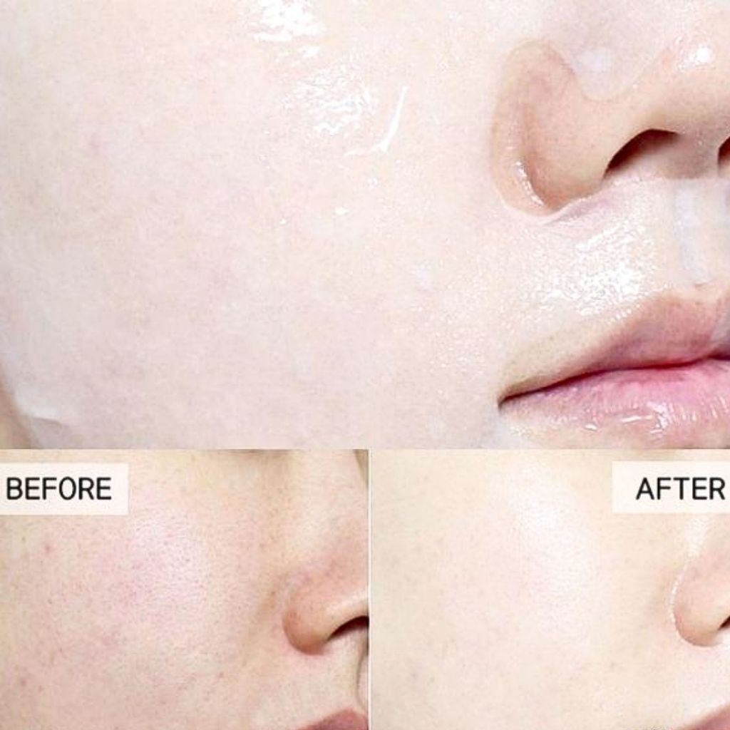 Mặt Nạ Mediheal Dermaplus Cấp Ẩm Dưỡng Sáng Phục Hồi Da Mask Hàn Quốc