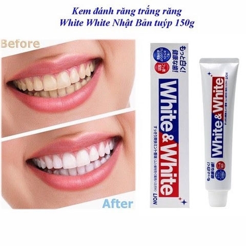 Lion - Combo 3 Kem Đánh Răng White And White Nhật Bản 3x150g