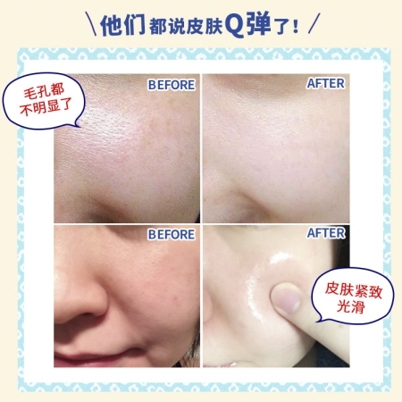 Keana - Kem Dưỡng Da Cám Gạo Keana Rice Cream 30g Dưỡng Ẩm Se Khít Lỗ Chân Lông