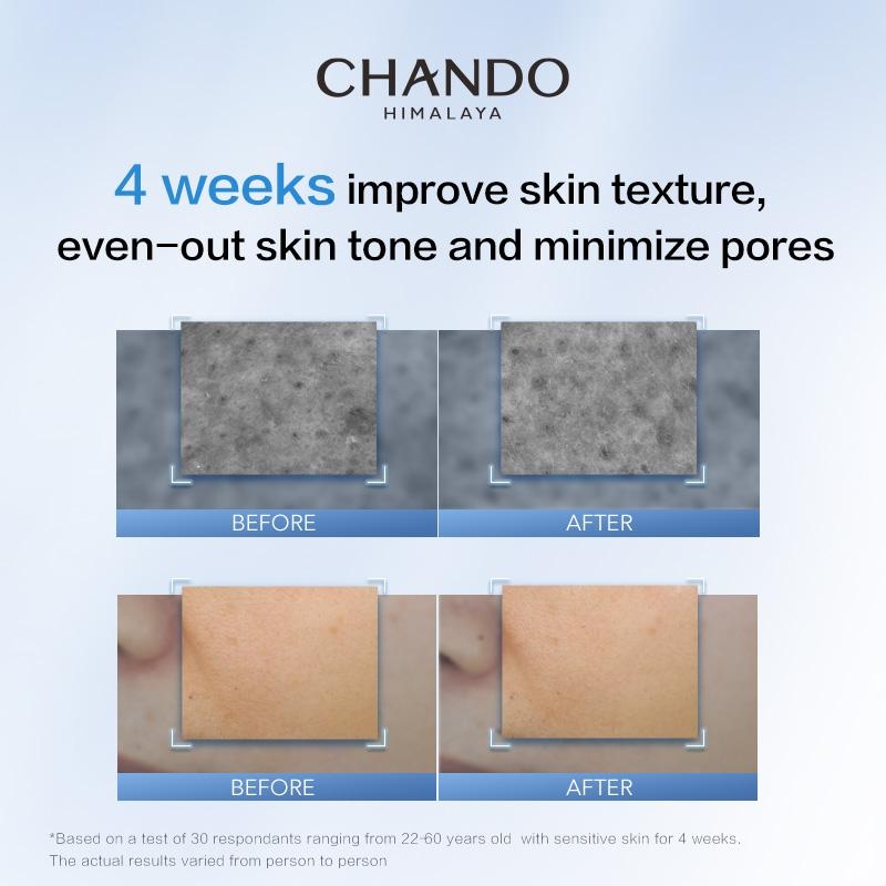 Chando Himalaya - Mặt Nạ Ống 2 Bước Niacinamide Làm Sạch Da Và Nuôi Dưỡng Da