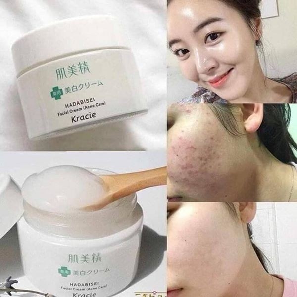 Kracie - Kem Dưỡng Da Trị Mụn Kracie Hadabisei Facial Cream 50g