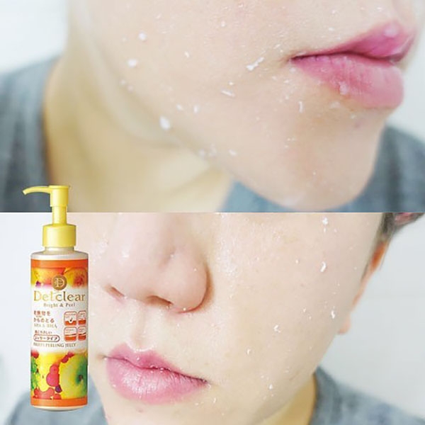MEISHOKU - Gel Tẩy Tế Bào Chết Detclear 180ml Màu Vàng (Hương Trái Cây)