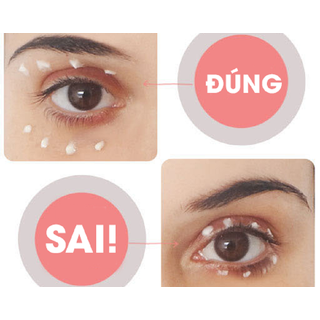 Kumargic - Kem Mắt Kumargic Xóa Thâm Quầng Và Bọng Mắt 20g