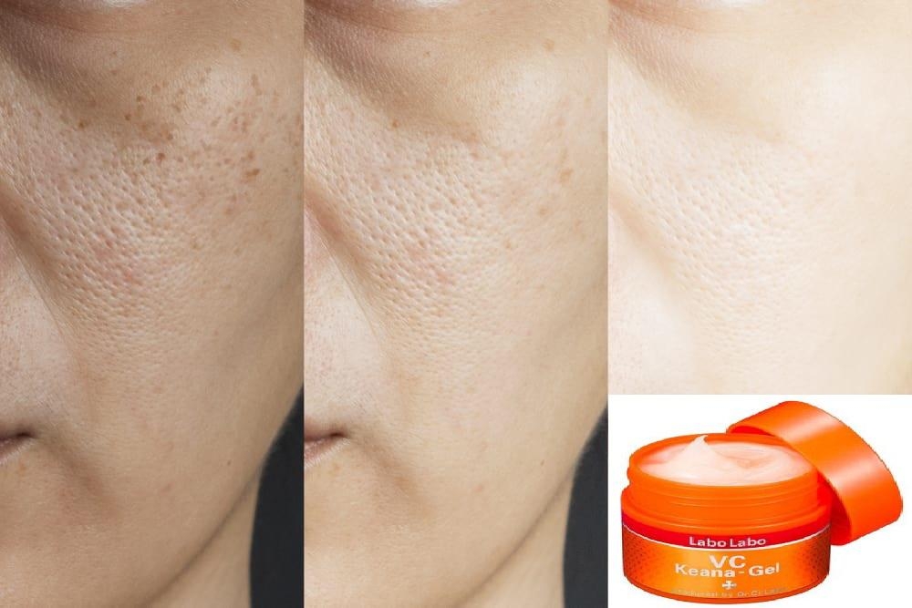 Dr.Ci Labo - Gel Dưỡng Ẩm Se Khít Lỗ Chân Lông Labolabo VC Keana 90g