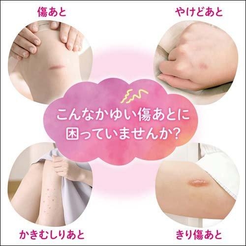 Kobayashi - Kem Trị Sẹo Kobayashi 10gr