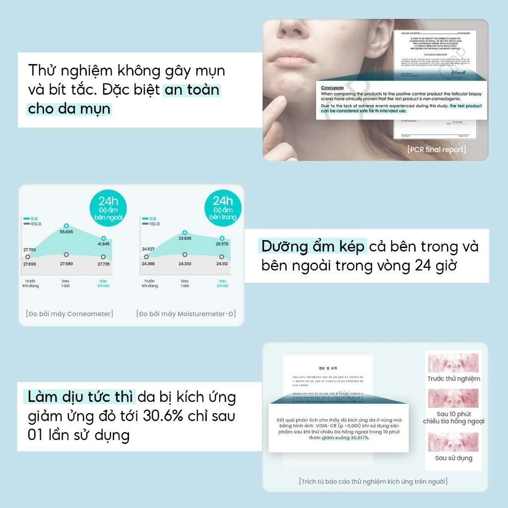 Kem dưỡng ẩm dịu da Beyond Angel Aqua Moisture Cream 150ml (BEYOND ANGEL AQUA MOISTURE CREAM)