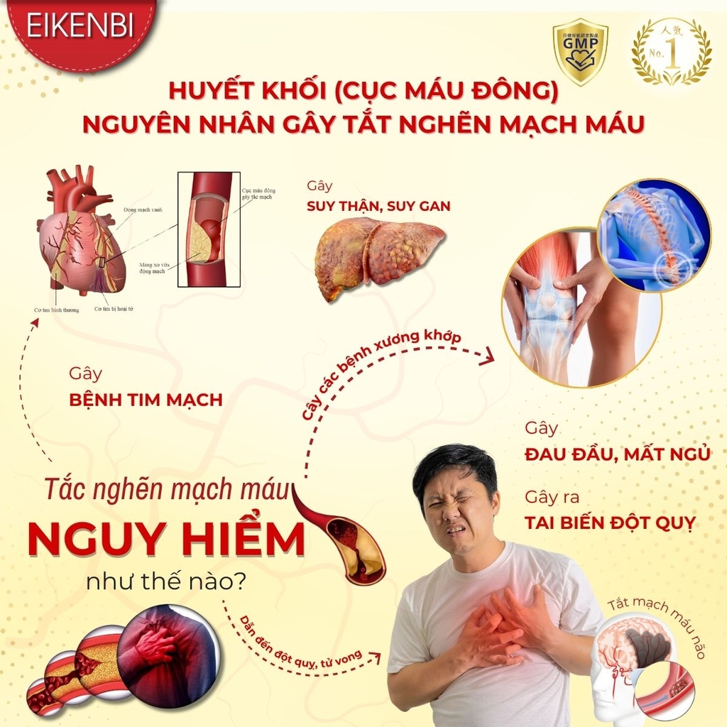 Viên Uống Lumbrokinase EX Eikenbi Tan Cục Máu Đông & Chống Đột Quỵ [60 viên]