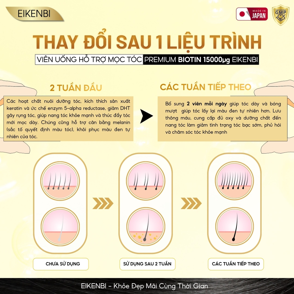 Viên Uống Mọc Tóc & Đen Tóc Black Grow Up Maximum Biotin 15,000µg Eikenbi [60 viên]