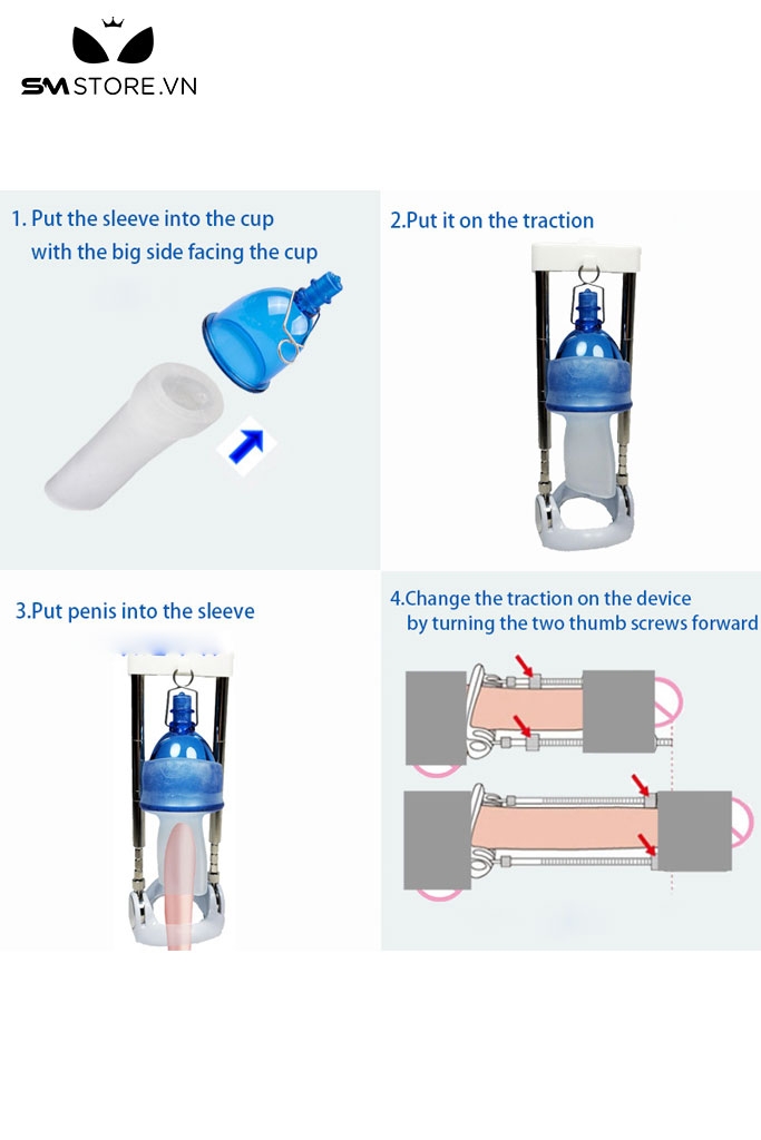 SMT3488 - Bộ hút chân không tăng kích thước dương vật hình cái chuông