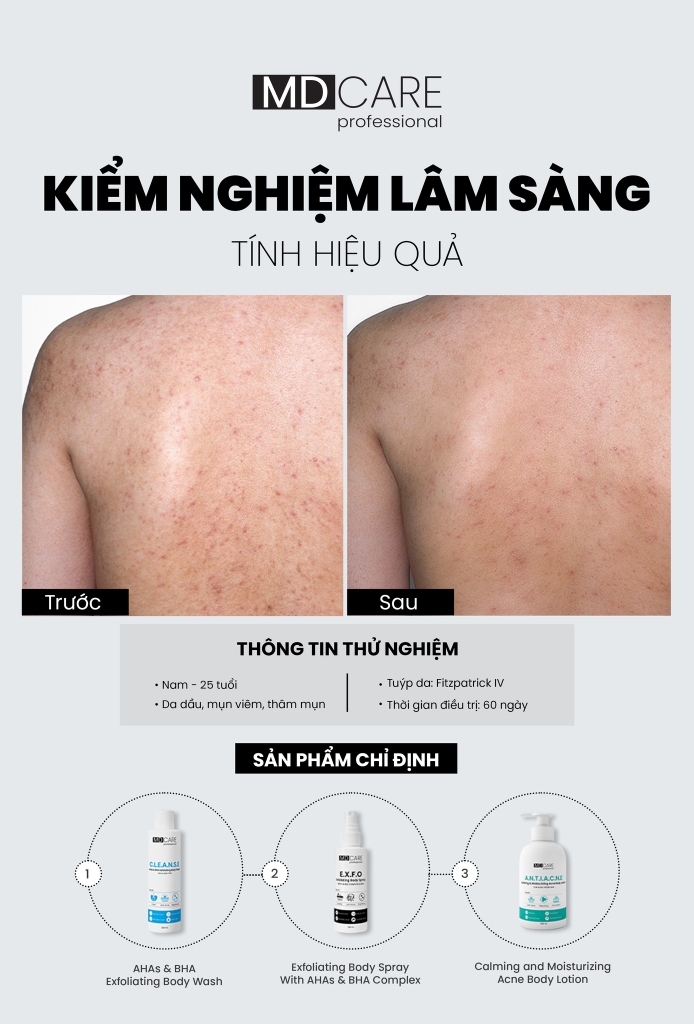 MD Care: Giải pháp Chăm sóc Da Khoa học Toàn diện từ da mặt đến body