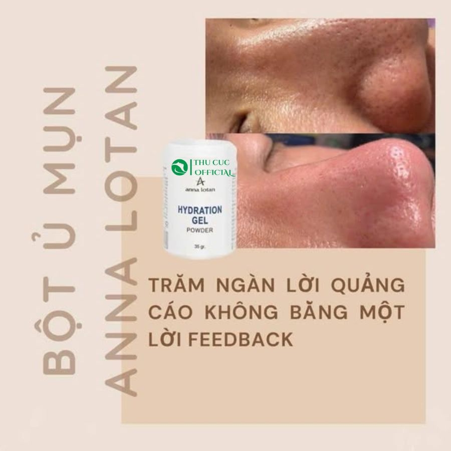 Bột ủ mụn Anna Lotan Hydration Gel Power 35g - Sạch mụn cực êm