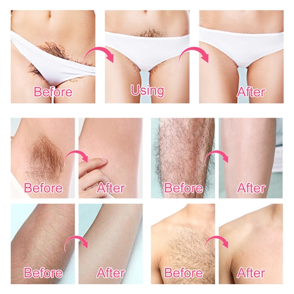 Kem tẩy lông vùng kín dành cho nữ Aliver Intimate Hair Removal Cream