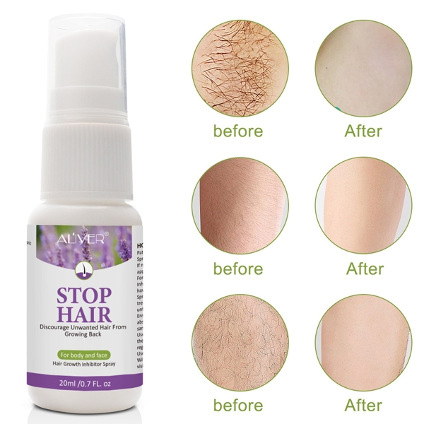 Xịt tẩy lông tự nhiên và ức chế mọc lại Aliver Stop Hair Growth Inhibitor Spray