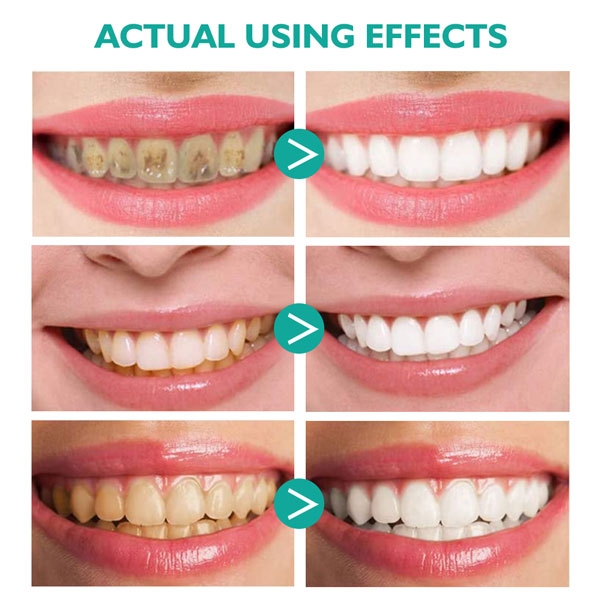 Kem đánh răng làm trắng răng Aliver hương trái cây Aliver Teeth Whitening Foaming