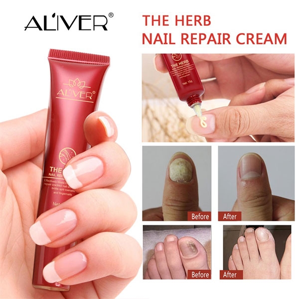 Kem dưỡng móng tay Aliver The Herb Nail Repair