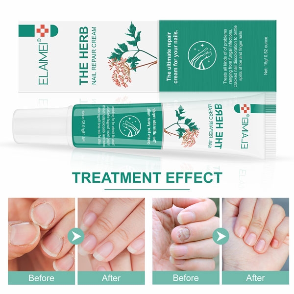 Kem Phục Hồi Và Nuôi Dưỡng Móng  Elaimei The Herb Nail Repair Cream 15g