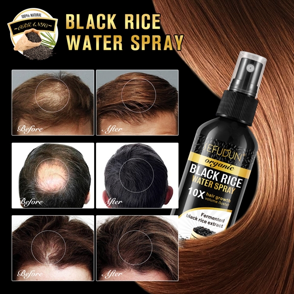 Chai Xịt Huyết Thanh Gạo Đen Mọc Tóc Sefudun Black Rice Water Spray