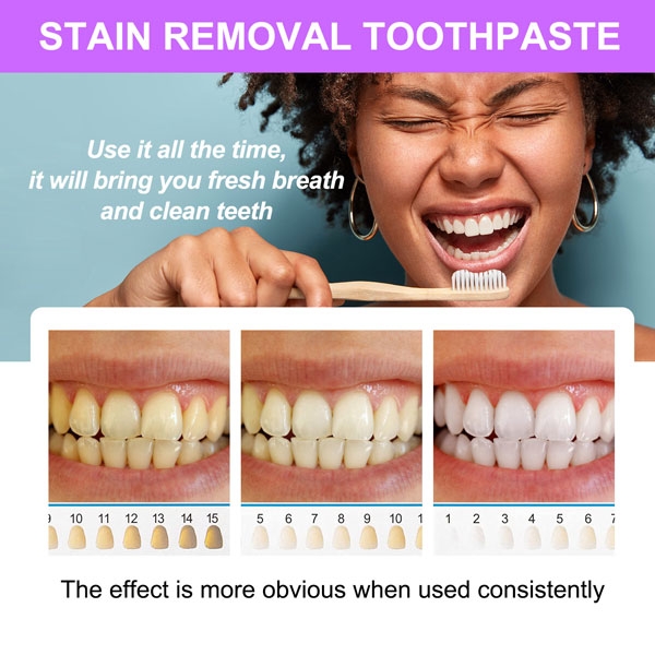 Kem làm trắng, sạch vôi răng dễ dàng Sefudun Stain Removal Whitening Toothpaste