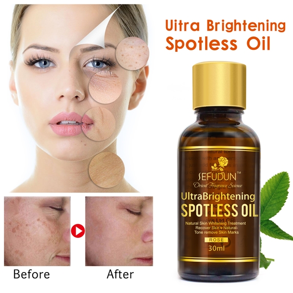 Serum Hoa Hồng Làm Trắng, Trị Tàn Nhang Sefudun Ultra Brightening Spotless Oil 