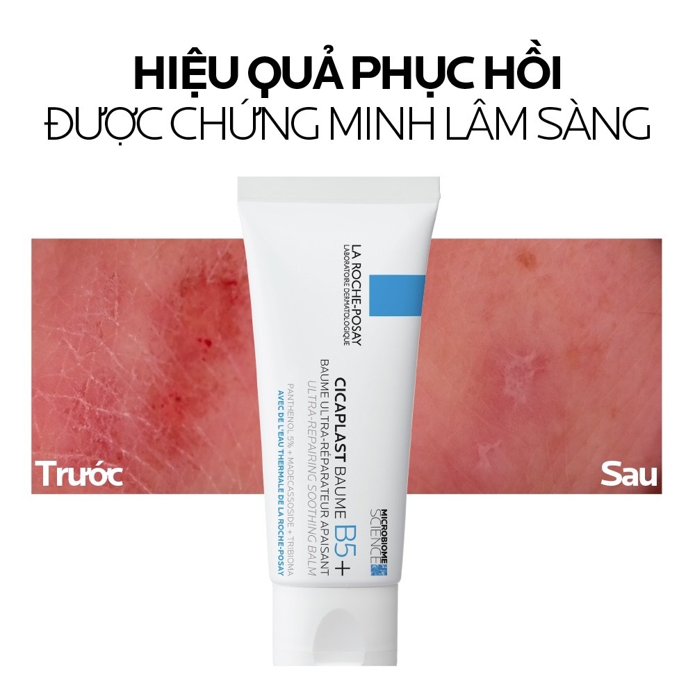 Kem Dưỡng Làm Dịu Phục Hồi Da La Roche-Posay Cicaplast Baume B5