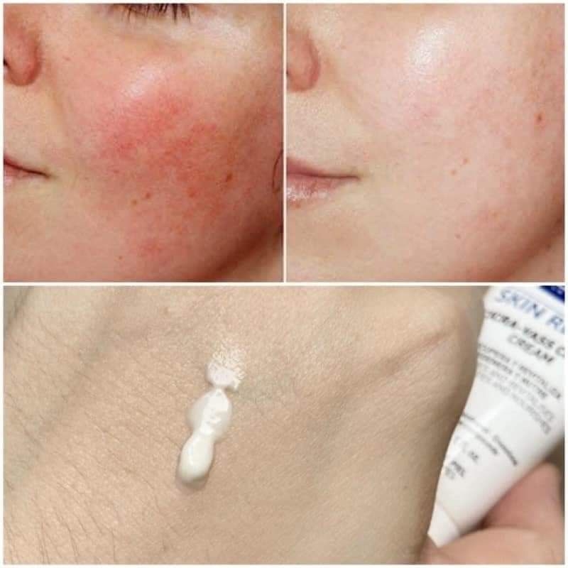 Kem Dưỡng  Làm Lành Da, Ngừa Nhiễm Khuẩn  Avene Cicalfate Repair Cream