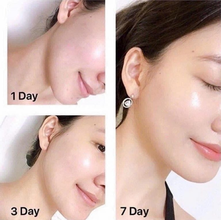 Kem Dưỡng Đêm Ngừa Lão Hóa Olay Total Effects 7 In One Night Firming Moisturiser