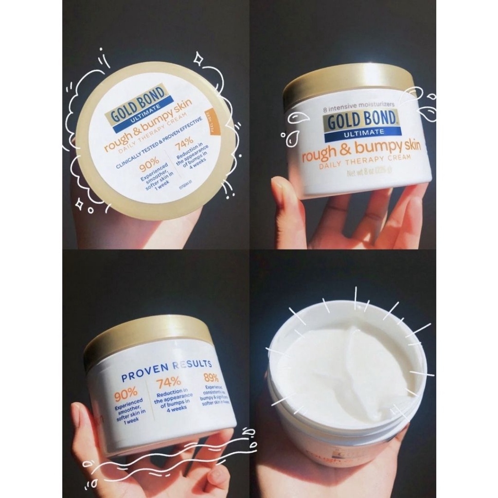 Kem Dưỡng Mông Gold Bond Ultimate Rough & Bumpy Daily Skin Therapy