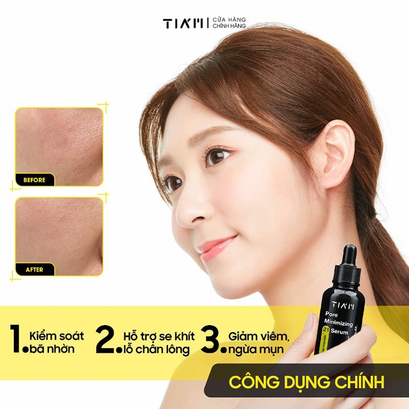Tinh Chất Serum Thu Nhỏ Lỗ Chân Lông, Kiểm Soát Dầu Nhờn Và Ngừa Mụn Tiam Niacinamide 20% + Zinc 1% Tiam Pore Minimizing 21