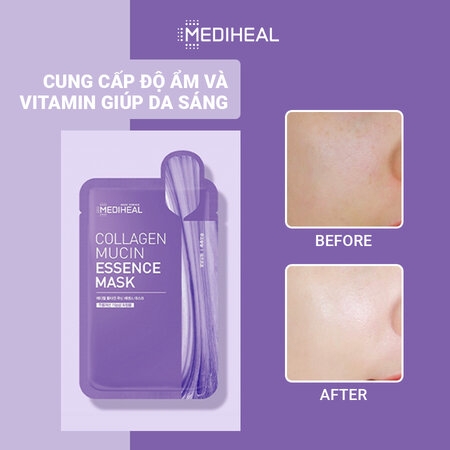 Mặt Nạ Cấp Ẩm, Dưỡng Sáng Da, Ngừa Lão Hóa Cao Cấp Mediheal Essence Mask 20ml