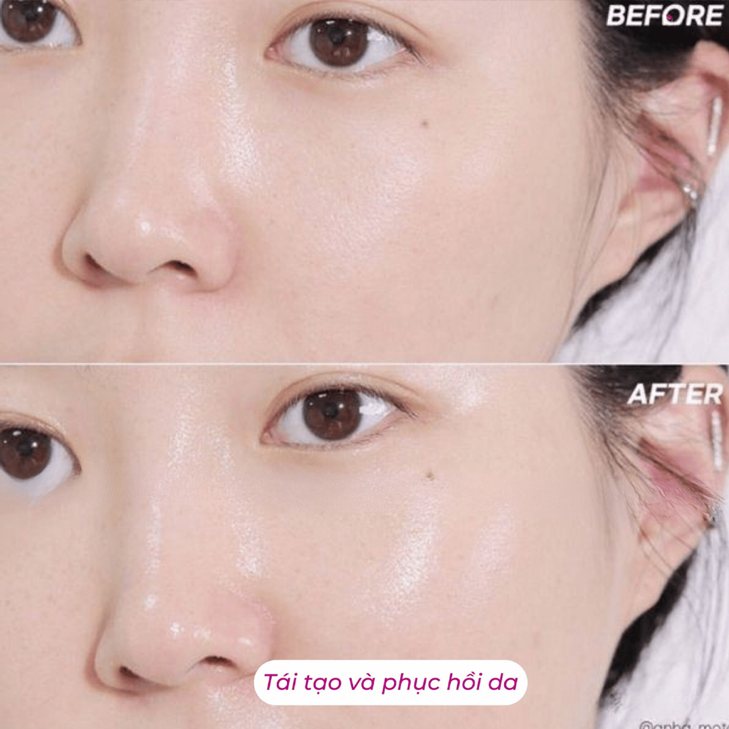 Mặt Nạ Trắng da , Phục Hồi Rosemine Whitening And Rejuvenating Mask