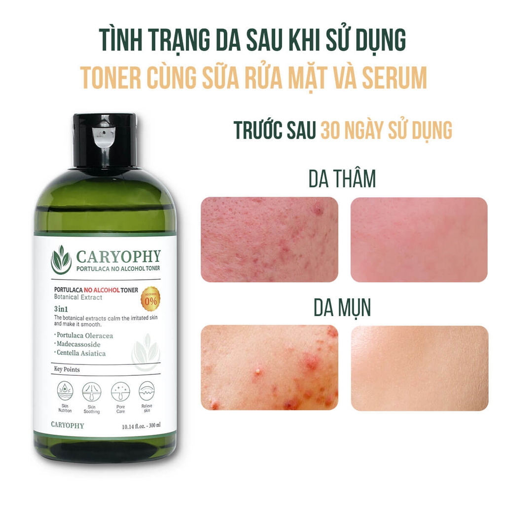 Nước Hoa Hồng Ngừa Mụn Kiềm Dầu Giảm Thâm Caryophy Portulaca Toner