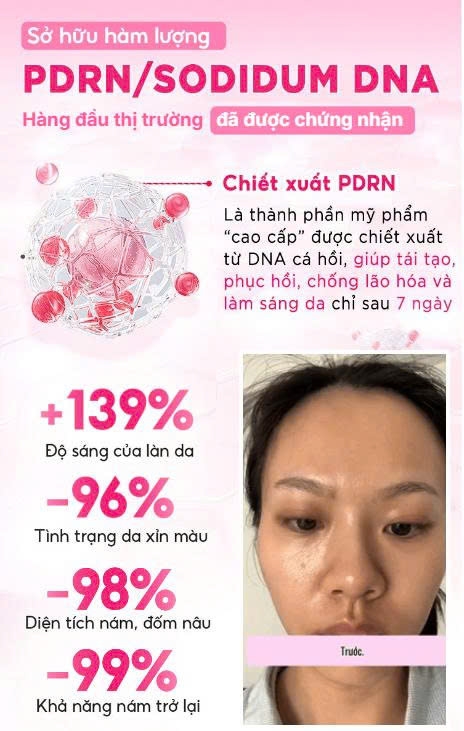 Combo 3 sản phẩm PDRN Hoa anh đào MIINSKIN (Toner xịt khoáng + Serum + Kem dưỡng)