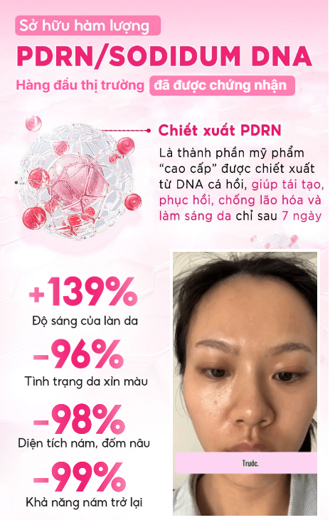 Toner Miinskin dạng xịt khoáng PDRN Hoa anh đào