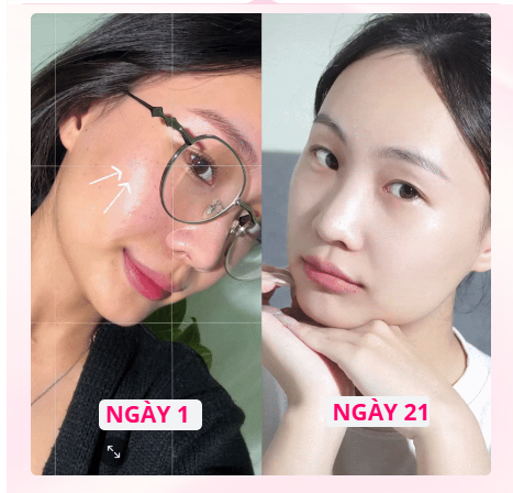 Toner Miinskin dạng xịt khoáng PDRN Hoa anh đào