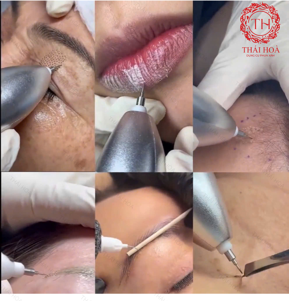 MÁY PLASMA VPLAS CHÍNH HÃNG – Tích Hợp 3 Chức Năng Nóng/Lạnh/Ấm