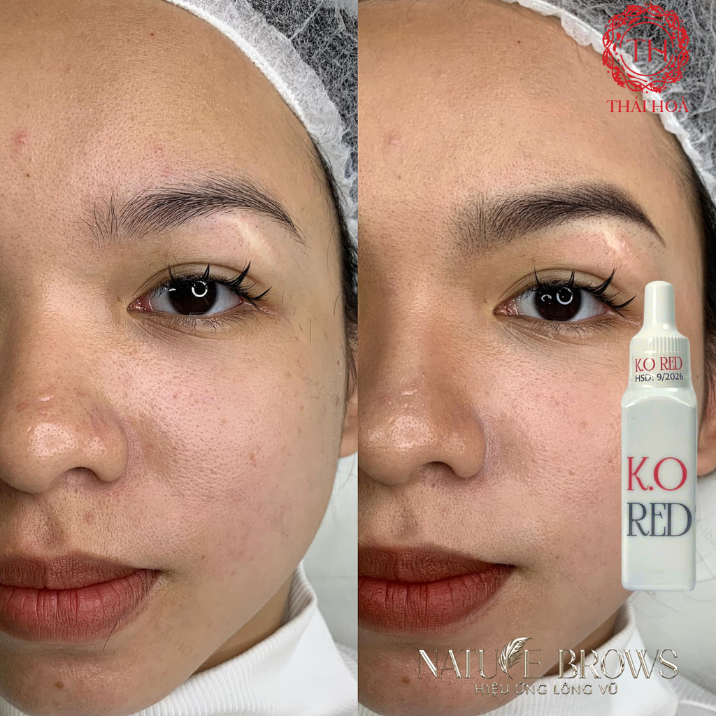 Gel Giảm Đỏ Chân Mày Sau Phun Xăm K.O Red - Làm Dịu Da Nhanh Chóng, An Toàn