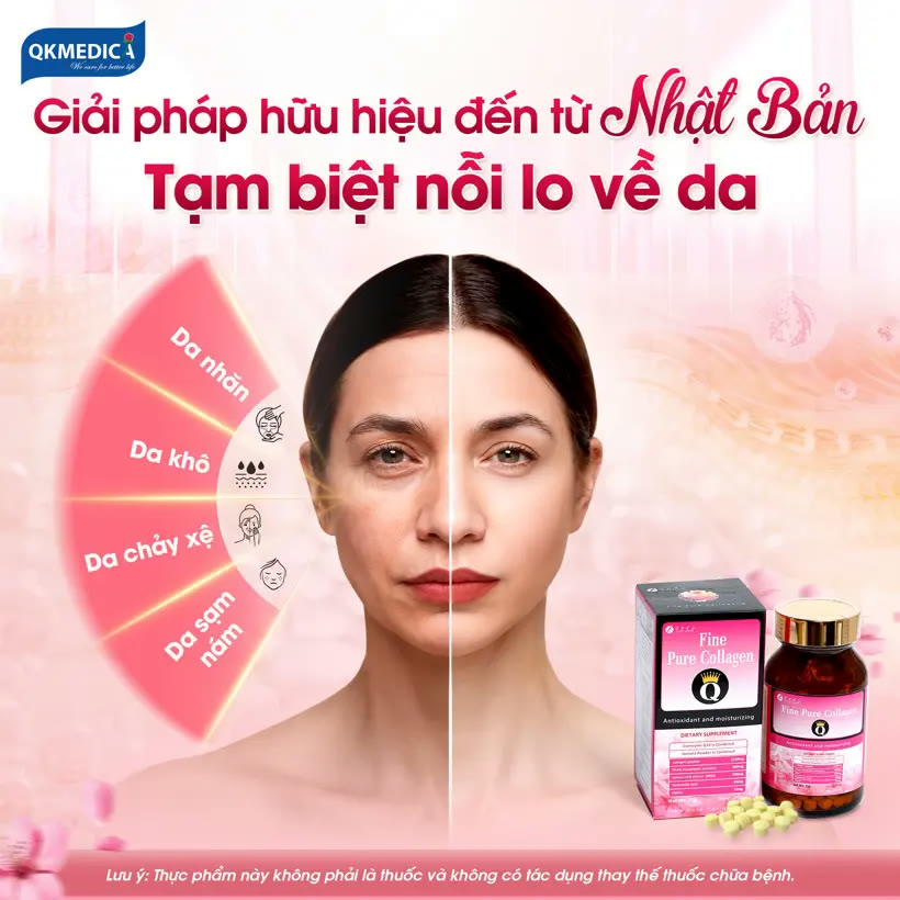 Thực phẩm bảo vệ sức khỏe Fine Pure Collagen Q (hộp 375 viên)