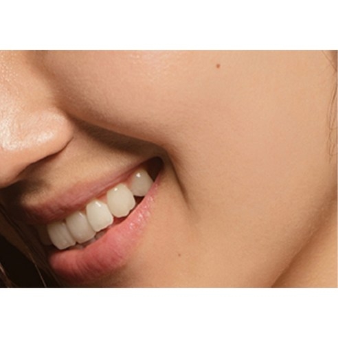 Kem Dán Trị Mụn Acnes