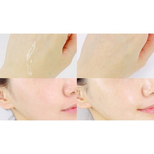 Sữa dưỡng ẩm Acnes 200ml